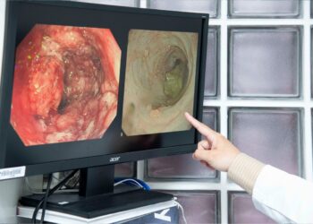 影音/女士15年深受腹瀉、腹痛、血便所苦　彰基助她戰勝腸炎陪兒娶媳婦