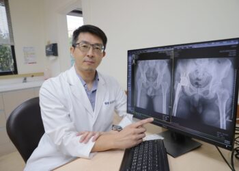 長期蹲站髖關節嚴重退化 置換人工髖關節重拾活動力
