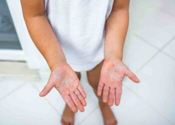 開學在即，腸病毒蠢蠢欲動？面對腸病毒威脅，家長要做好的「4個預防」！