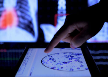 癌症再登國人死因首位！北市今年整合性篩檢起跑，增胃癌與HPV檢測！