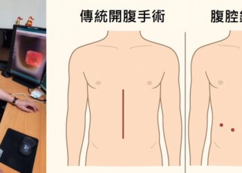 高雄市立大同醫院精準診斷　成功完成高齡胃癌病患微創全胃切除手術