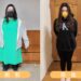 藥物、飲控無助減重 112公斤女胃繞道手術逆轉肥胖