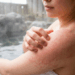 泡湯危「肌」重重！慢性肌膚可以泡溫泉嗎？ 醫提不傷肌「5建議」