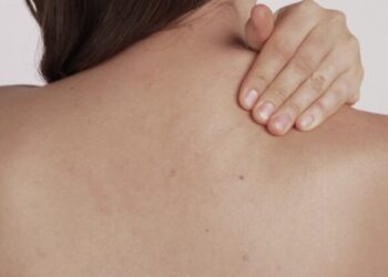 肩膀、手臂刺痛誤以為頸椎神經病變，原來是帶狀疱疹導致 醫揭：疼痛性質不同！